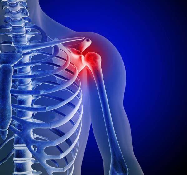 shoulder Personal Injury: Shoulder Injury
