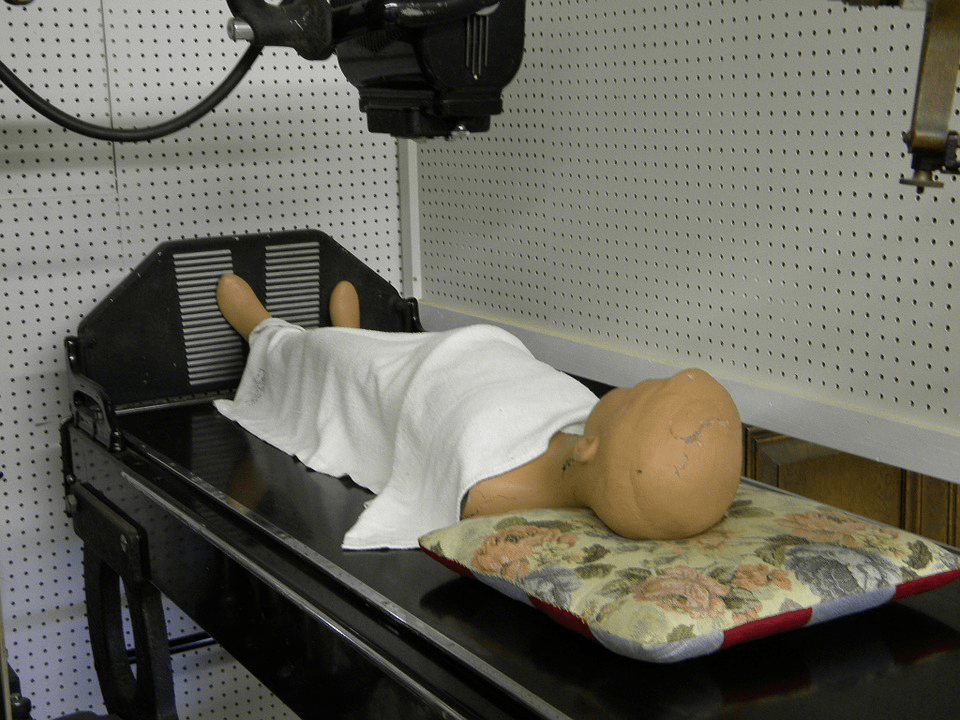 syndrome_crowsonlaw Concussion Syndrome Claims