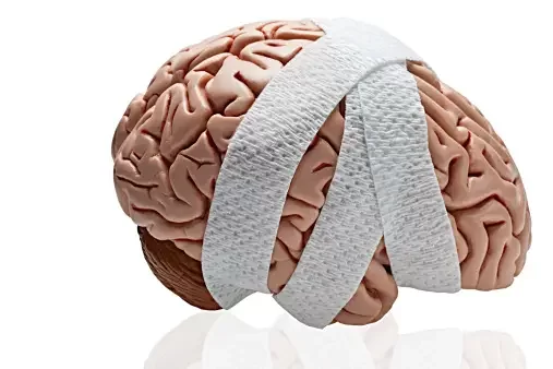 Traumatic Brain Injuries Caused by Negligence