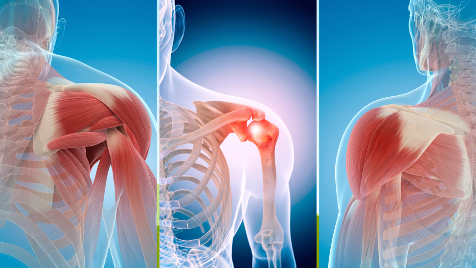 Valuing A Shoulder Injury Claim In Alaska Valuing A Shoulder Injury Claim In Alaska